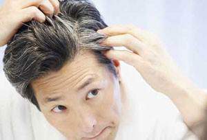 image درمان های خانگی برای جلوگیری از سفید شدن زود موهای سر