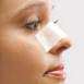 image آموزش نحوه صحیح مراقبت از بینی بعد از عمل جراحی زیبایی