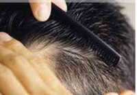 image لیست کامل تمام درمان های علمی خانگی گیاهی داروئی برای ریزش مو