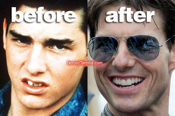 image عکس های قبل و بعد از معروف شدن افراد مشهور
