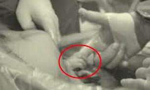image عکس جالب نوزادی که در هنگام لحظه تولد دست پزشک خود را گرفت