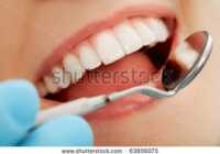 image آموزش سریع ترین روش جرمگیری دندان در خانه