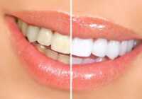 image دندان های خود را در خانه و با مواد طبیعی مثل مروارید درخشان کنید