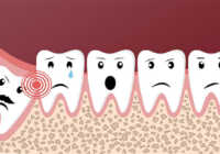 image نکته های خواندنی و علمی درباره دندان عقل