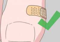 image راهکارهای مفید برای درمان تاول پا