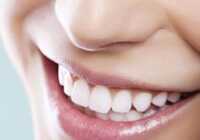 image راهکار مفید سفید کردن دندان ها بدون هزینه اضافی در خانه