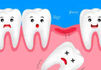 image معنی و تفسیر افتادن دندان در خواب چیست