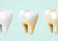 image علت زرد بودن همیشگی دندان ها چیست