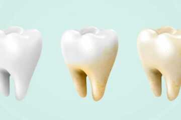 image علت زرد بودن همیشگی دندان ها چیست